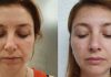 Masajul facial, gatului și decolteului – beneficii și mituri masajul facial inainte dupa